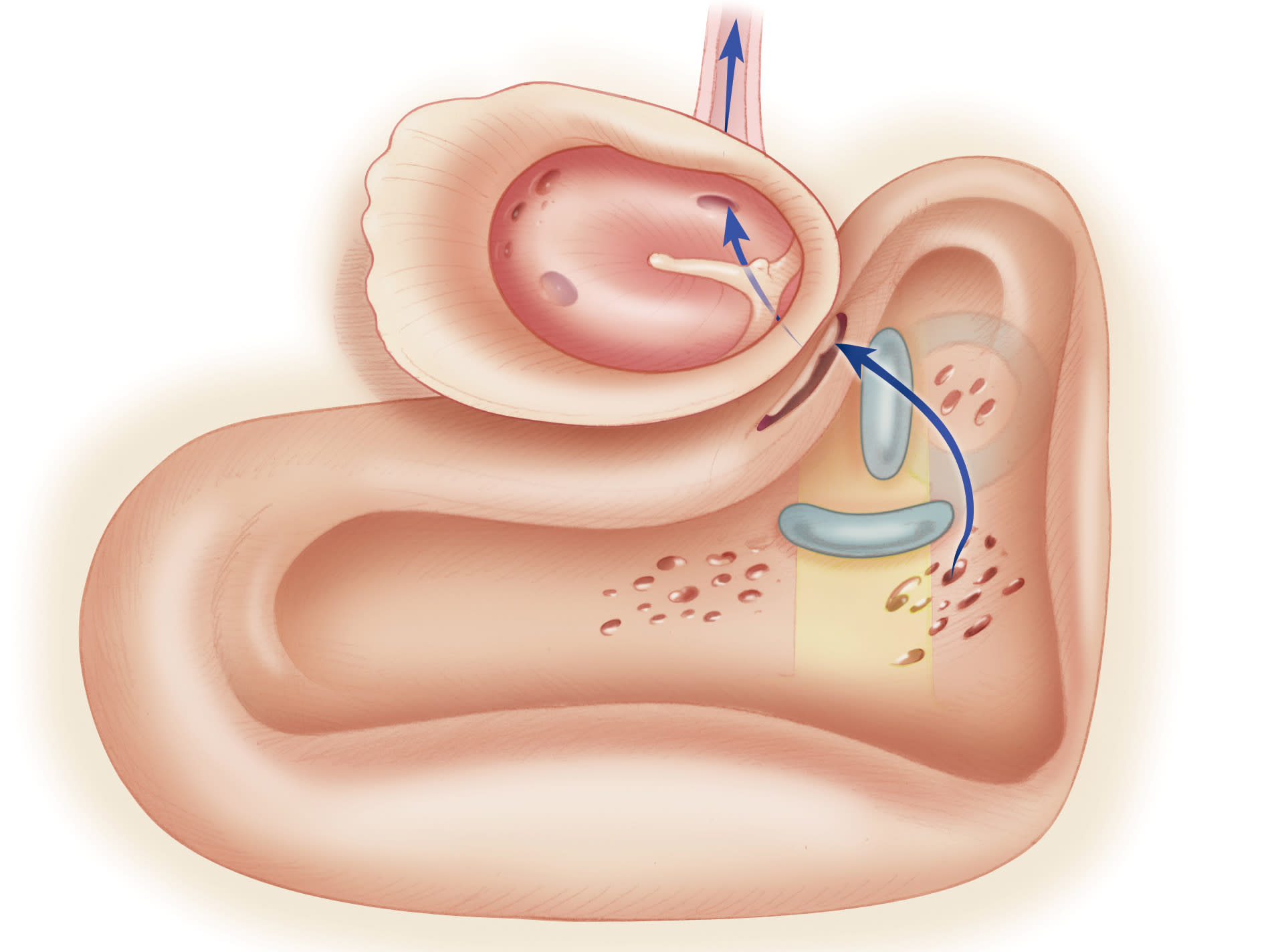 Cerebrospinal Fluid Leak | Jackler Collection | Volumes Cerebrospinal Fluid Leak | Jackler Collection | Volumes